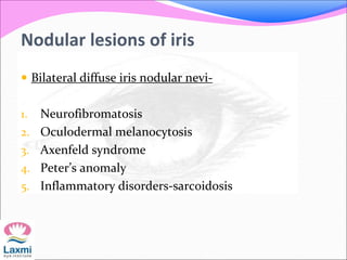 Nodular lesions of iris
 Bilateral diffuse iris nodular nevi-
1. Neurofibromatosis
2. Oculodermal melanocytosis
3. Axenfeld syndrome
4. Peter’s anomaly
5. Inflammatory disorders-sarcoidosis
 