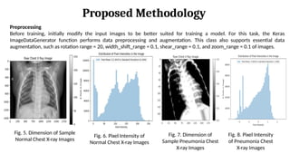 Shearing Augmentation Detection and Classification of Pneumonia with Chest X-Ray Images using ...