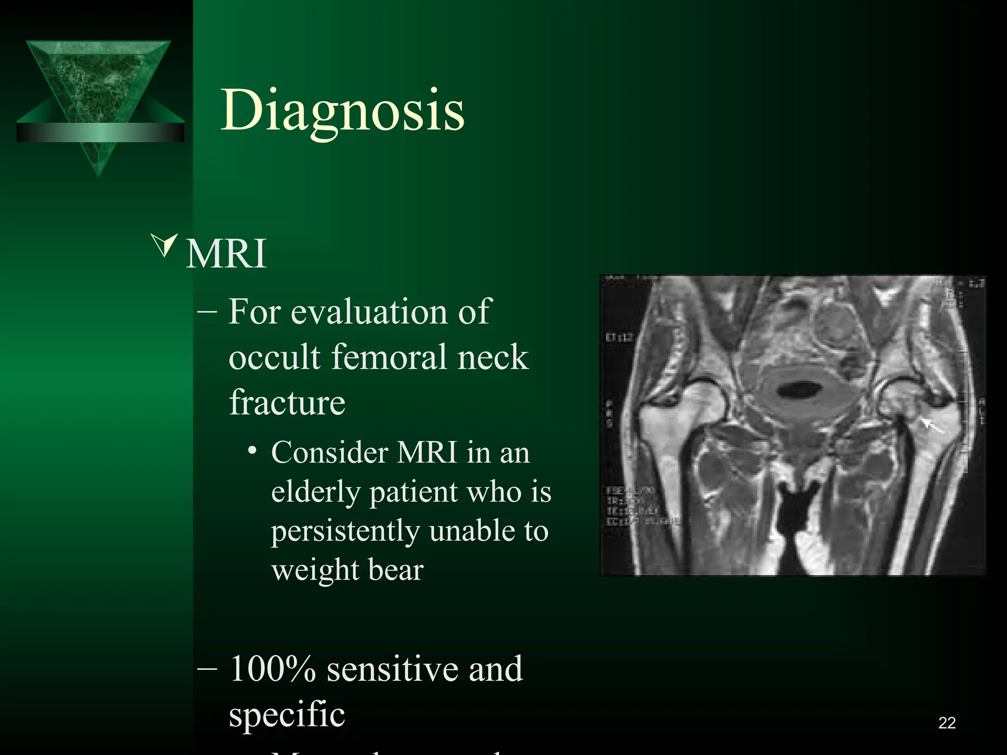 22
MRI
– For evaluation of
occult femoral neck
fracture
• Consider MRI in an
elderly patient who is
persistently unable to
weight bear
– 100% sensitive and
specific
Diagnosis
 