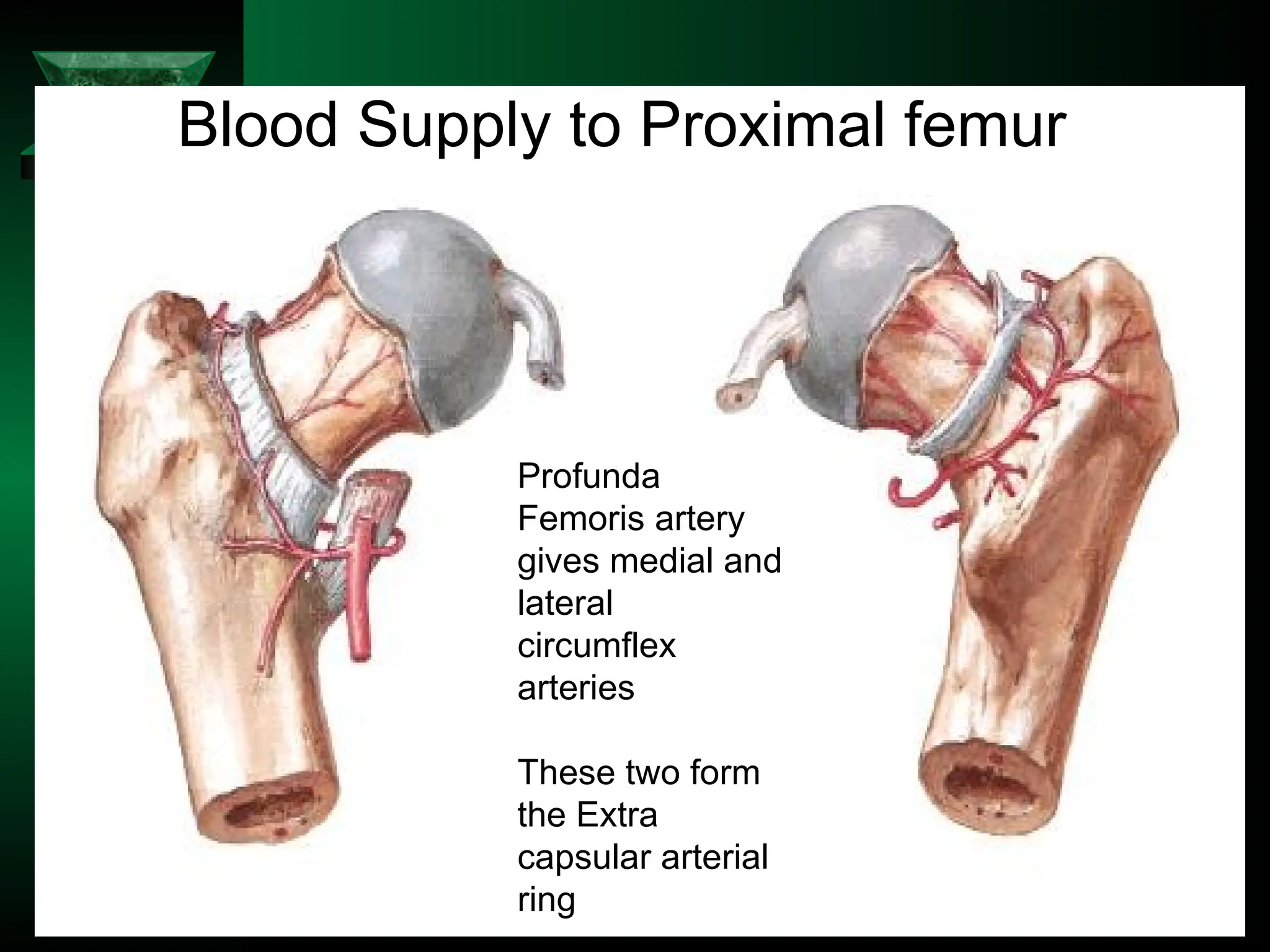 Profunda
Femoris artery
gives medial and
lateral
circumflex
arteries
These two form
the Extra
capsular arterial
ring
Blood Supply to Proximal femur
 