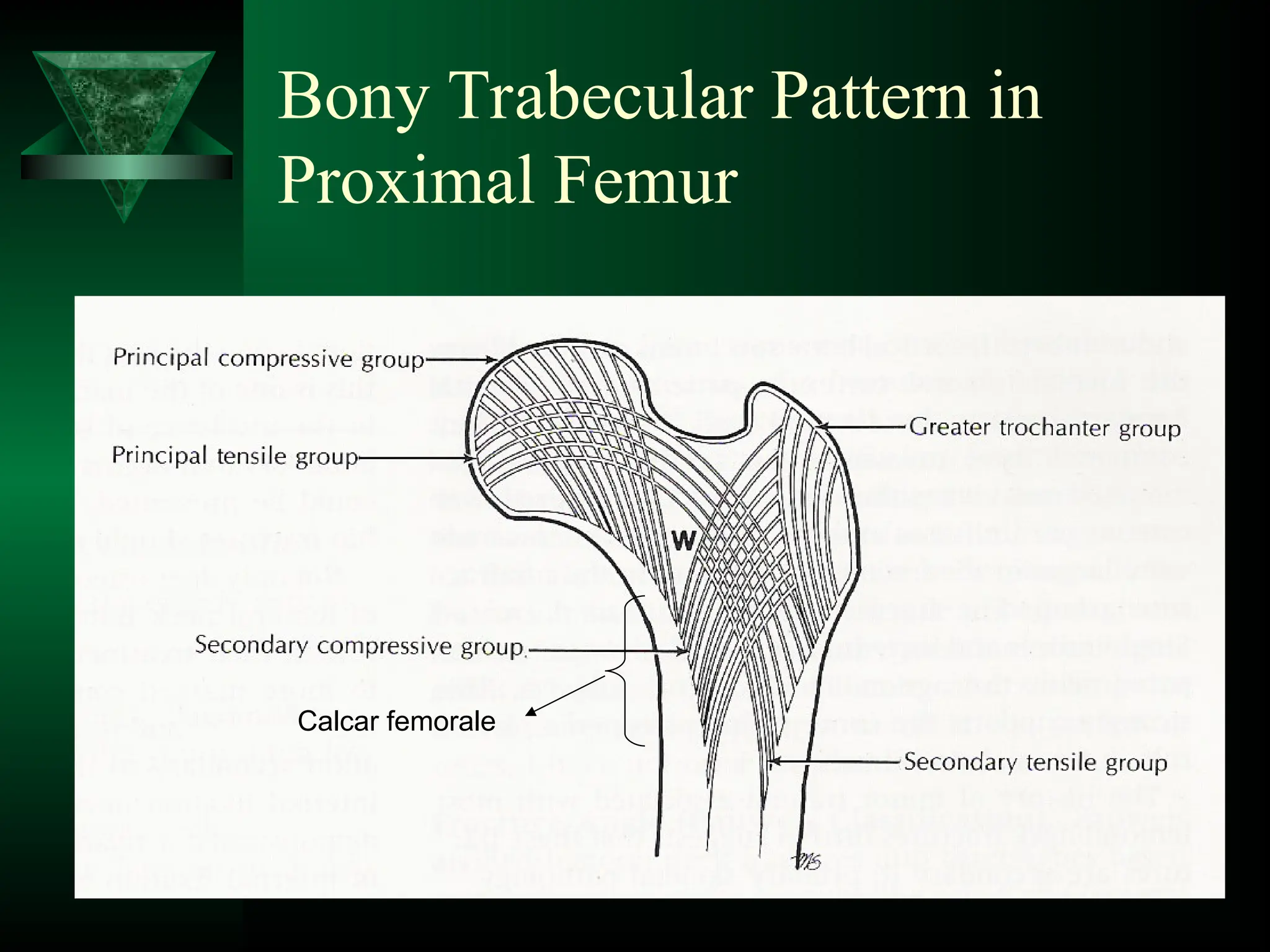 Bony Trabecular Pattern in
Proximal Femur
Calcar femorale
 