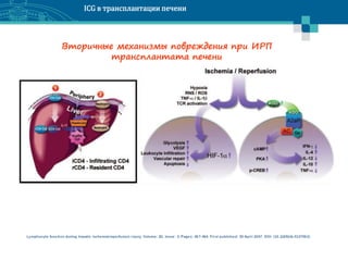 ICG in liver transplantation