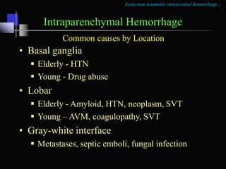 Acute non-traumatic intracranial hemorrhage…
Intraparenchymal Hemorrhage
AVM
• Bleeding from the nidus or the proximal por...