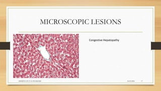 MICROSCOPIC LESIONS
24-09-2020ABHIJITH SP CVAS POOKODE 17
Congestive Hepatopathy
 
