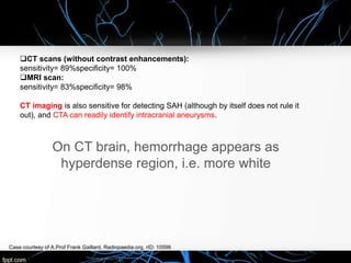 Intracerebral Hemorrhage Case presentation | PPTX