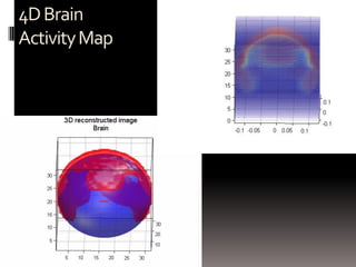 4DBrain
ActivityMap
 
