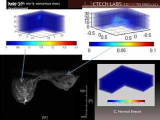 MRI 3T
MRI 3T
A. Breast with early cancerous mass
development
B. Breast with significant cancerous mass
C. Normal Breast
CTECH LABS EDWAR TECHNOLOGY
 
