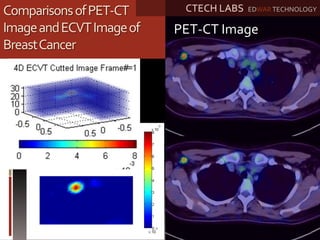 ComparisonsofPET-CT
ImageandECVTImageof
BreastCancer
ECVT Image
PET-CT Image
CTECH LABS EDWAR TECHNOLOGY
 