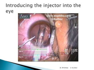 3/18/2022
Dr. M N Khan
 