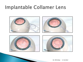 3/18/2022
Dr. M N Khan
 