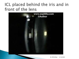 3/18/2022
Dr. M N Khan
 