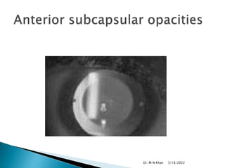 3/18/2022
Dr. M N Khan
 