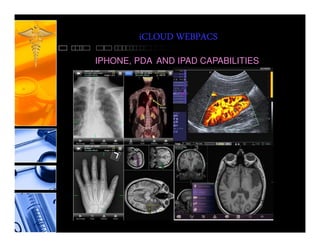 iCLOUD WEBPACS
IPHONE, PDA AND IPAD CAPABILITIES
 