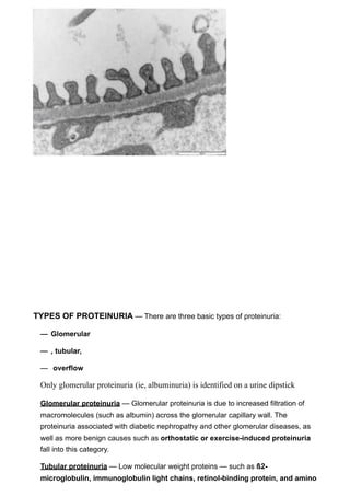 TYPES OF PROTEINURIA — There are three basic types of proteinuria:

 — Glomerular

 — , tubular,

 — overflow

 Only glomerular proteinuria (ie, albuminuria) is identified on a urine dipstick

 Glomerular proteinuria — Glomerular proteinuria is due to increased filtration of
 macromolecules (such as albumin) across the glomerular capillary wall. The
 proteinuria associated with diabetic nephropathy and other glomerular diseases, as
 well as more benign causes such as orthostatic or exercise-induced proteinuria
 fall into this category.

 Tubular proteinuria — Low molecular weight proteins — such as ß2-
 microglobulin, immunoglobulin light chains, retinol-binding protein, and amino
 