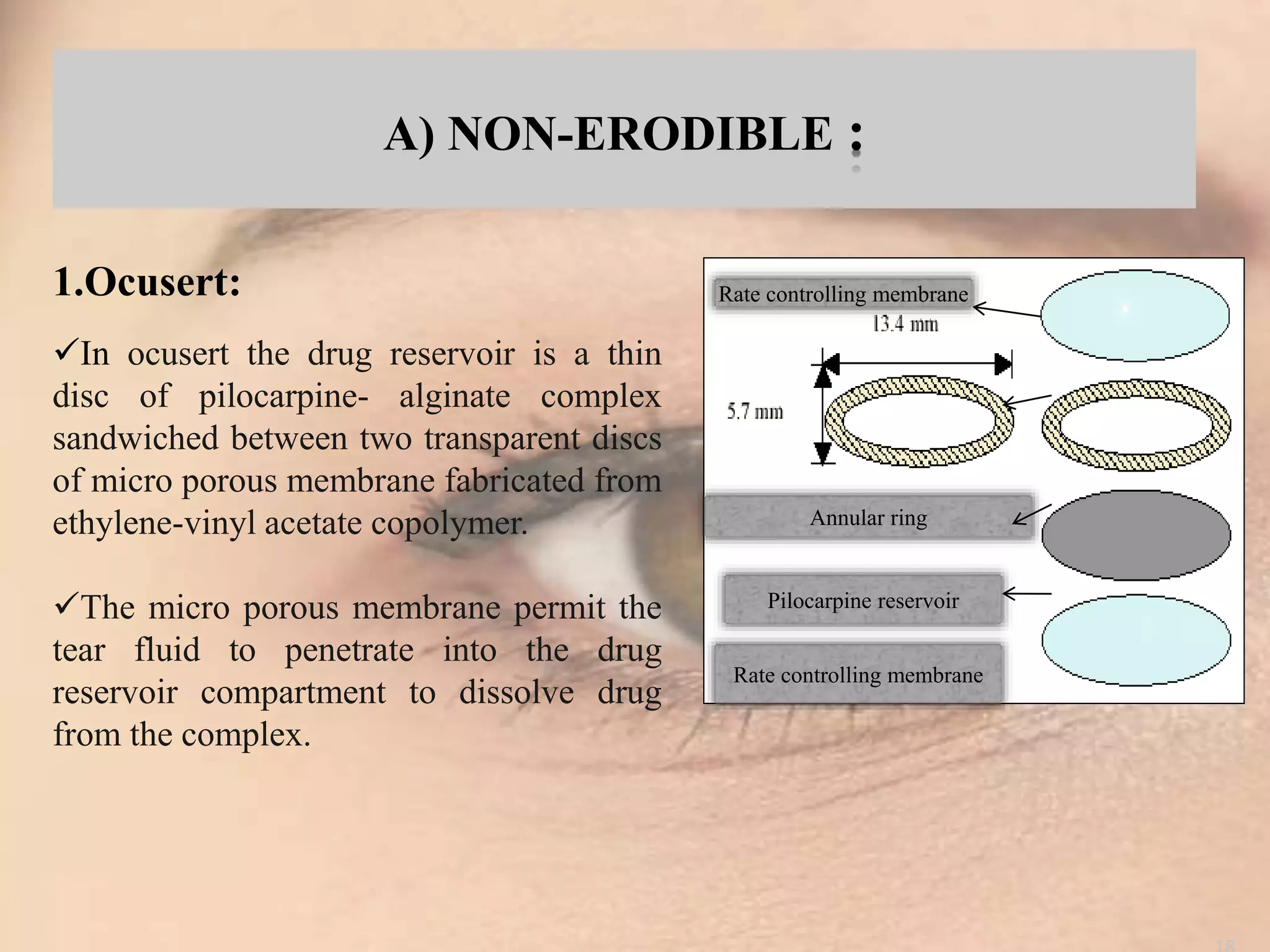 ocular drug delivary system..... | PPTX
