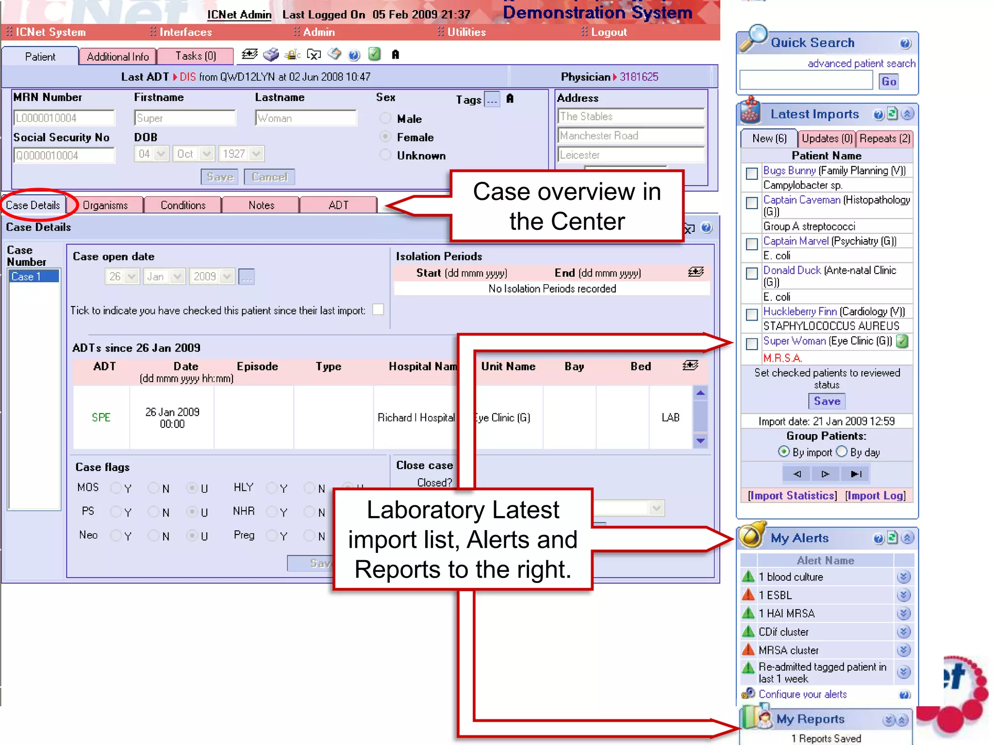 Case overview in the CenterLaboratory Latest import list, Alerts and Reports to the right.