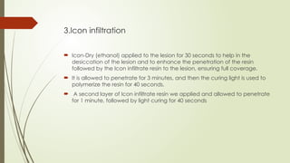 Therapeutic Evaluation of ICON Resin for White Spot Lesions in Esthetic ...
