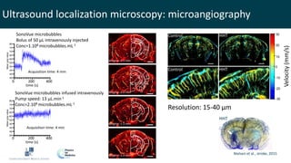 Microvascular & Functional Ultrasound Imaging: Insights into Stroke and ...