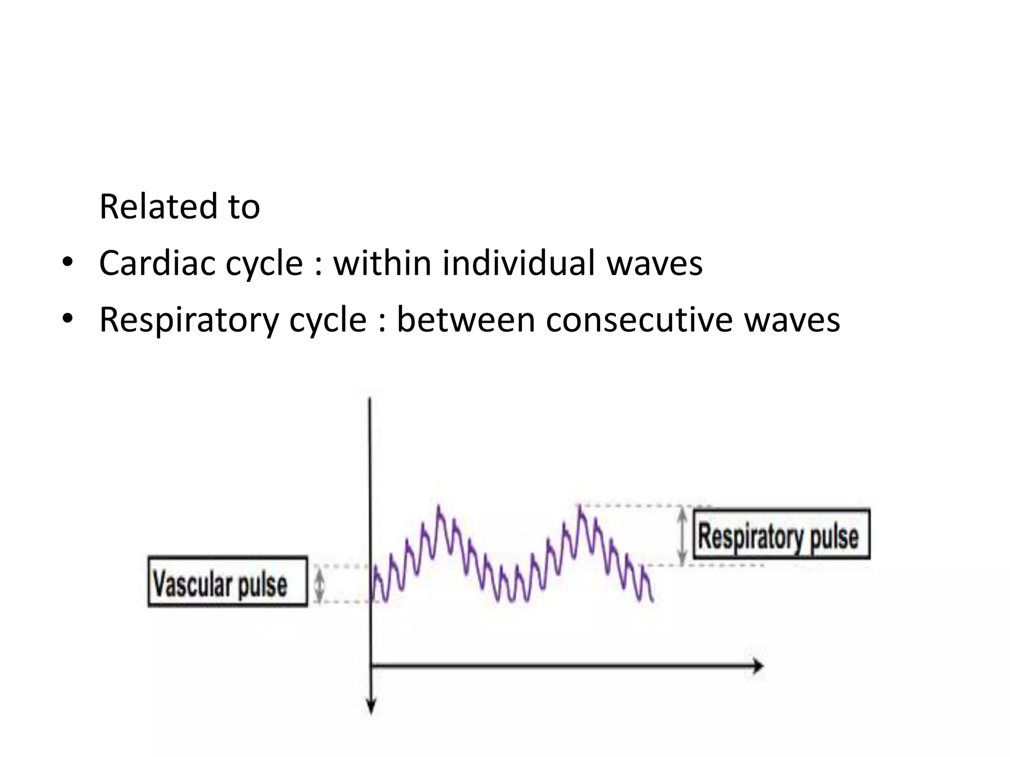 Related to
• Cardiac cycle : within individual waves
• Respiratory cycle : between consecutive waves

 