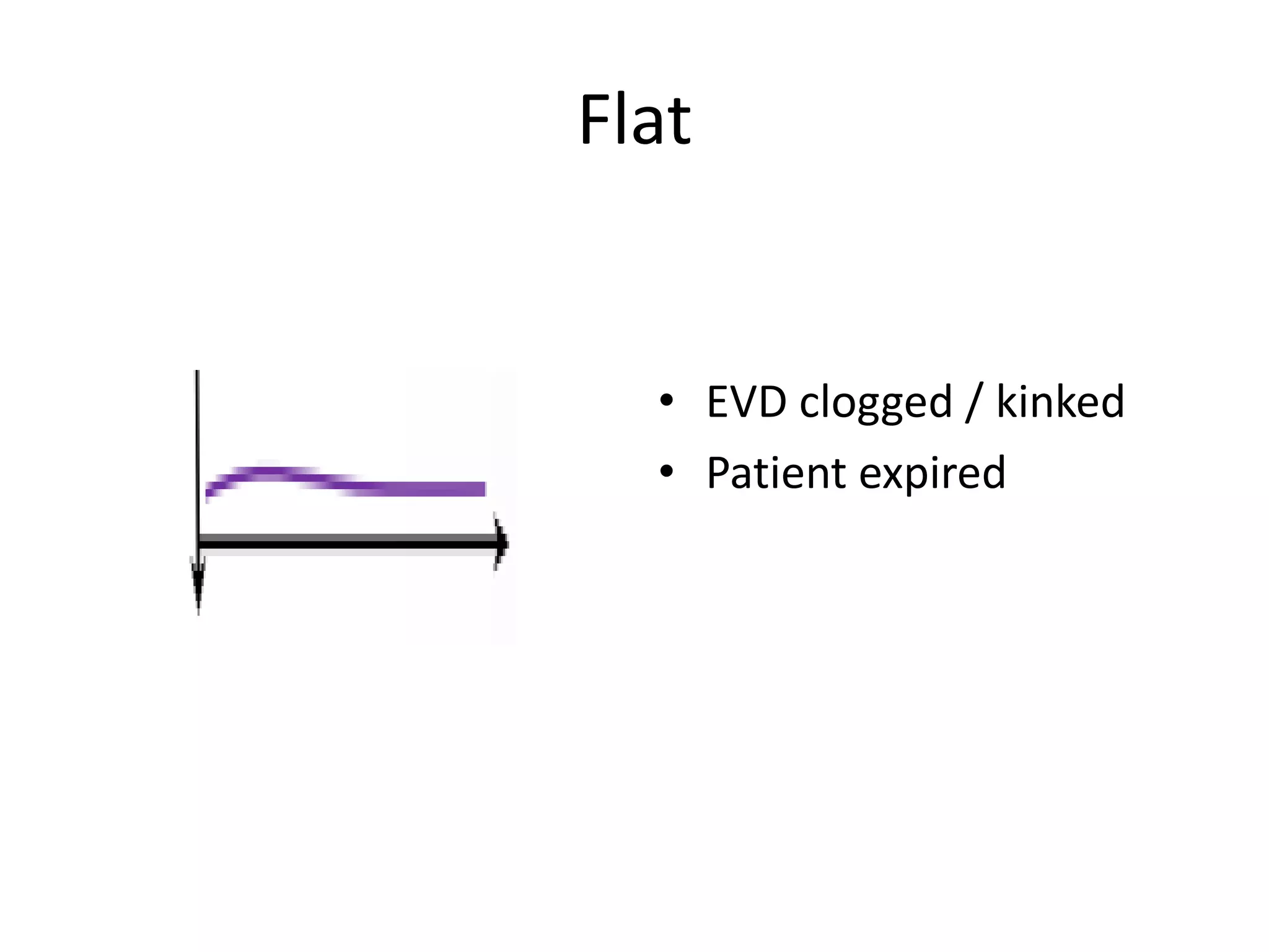 Flat

• EVD clogged / kinked
• Patient expired

 