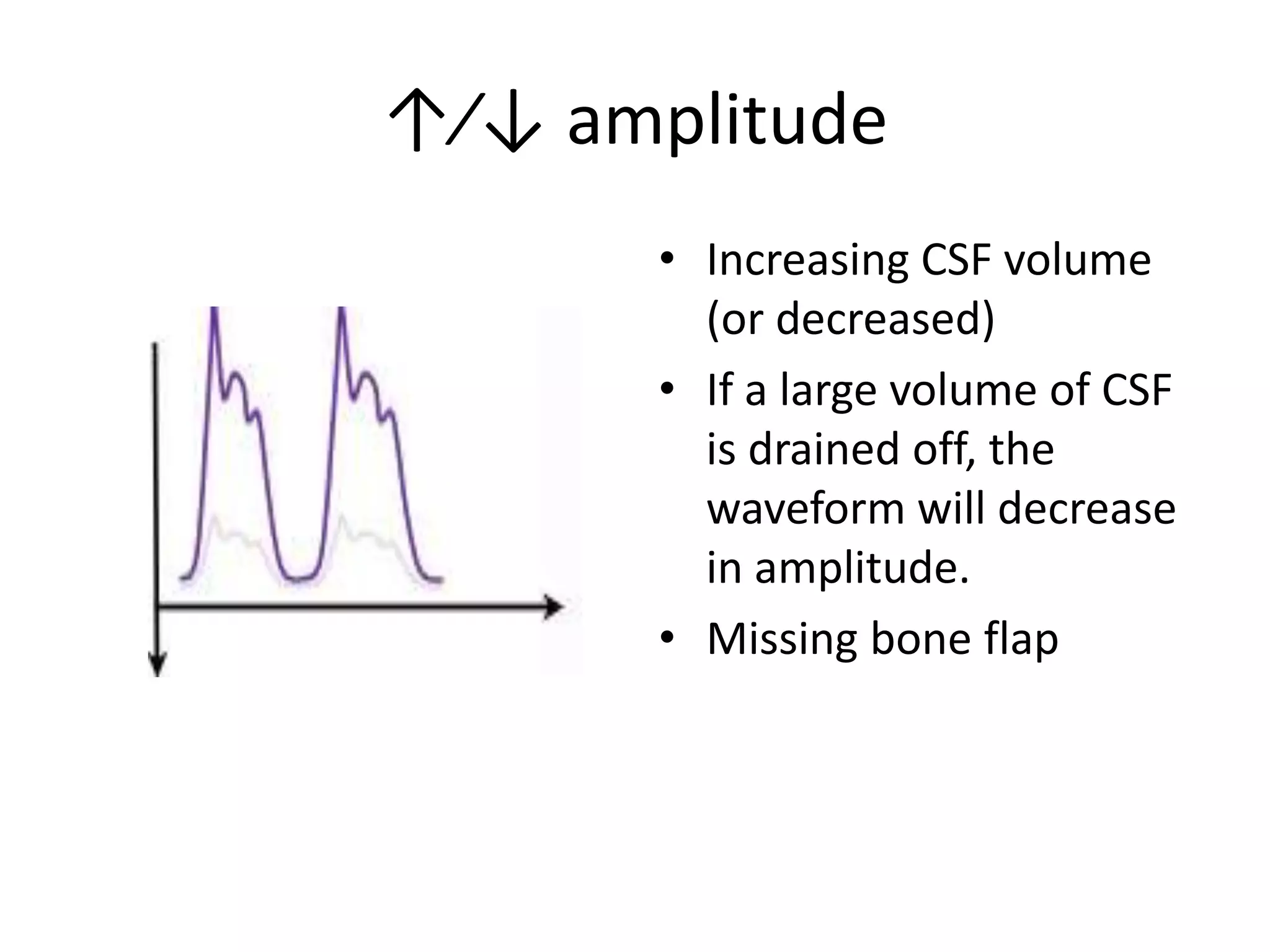 ↑⁄↓ amplitude
• Increasing CSF volume
(or decreased)
• If a large volume of CSF
is drained off, the
waveform will decrease
in amplitude.
• Missing bone flap

 