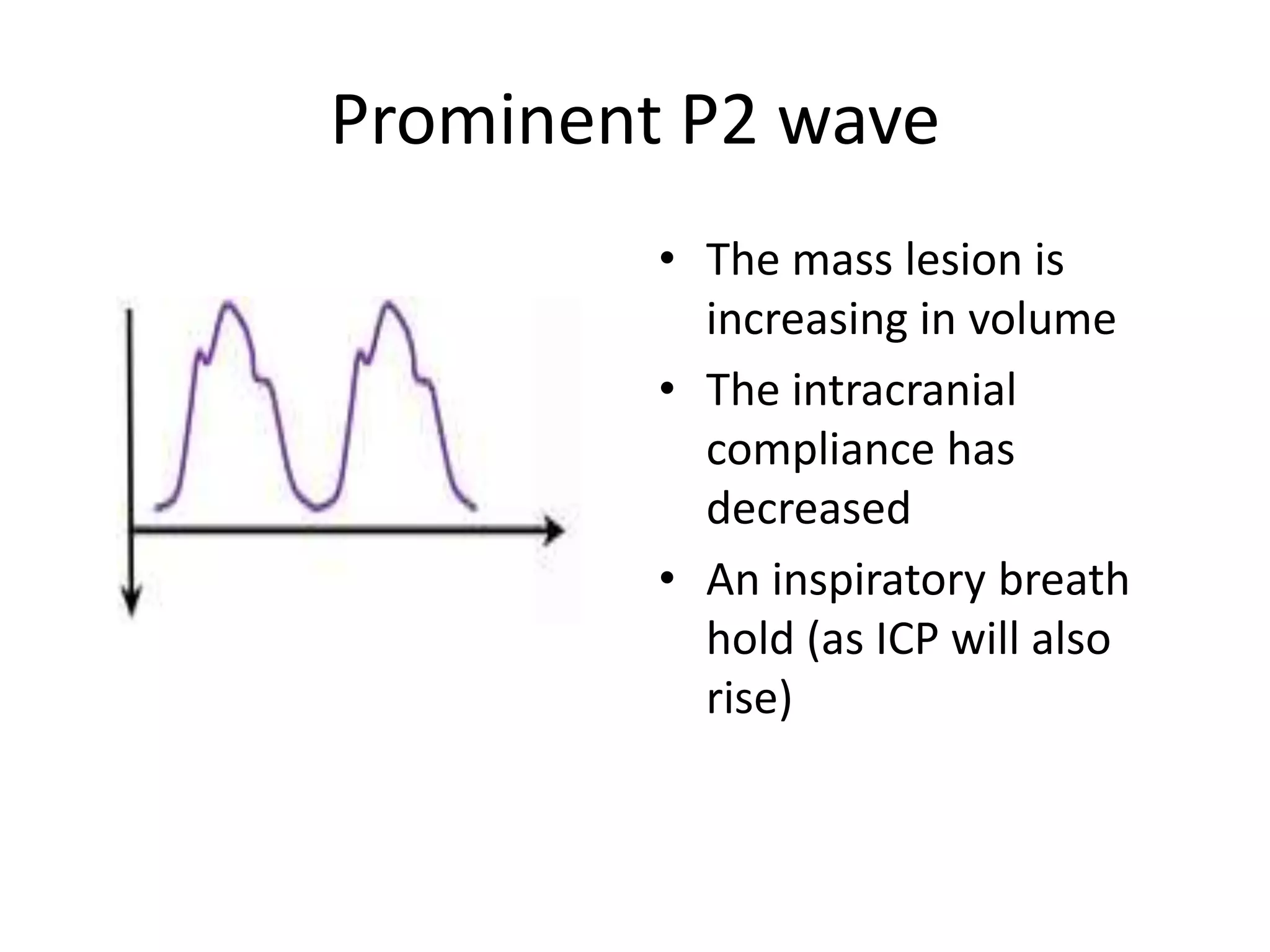 Prominent P2 wave
• The mass lesion is
increasing in volume
• The intracranial
compliance has
decreased
• An inspiratory breath
hold (as ICP will also
rise)

 