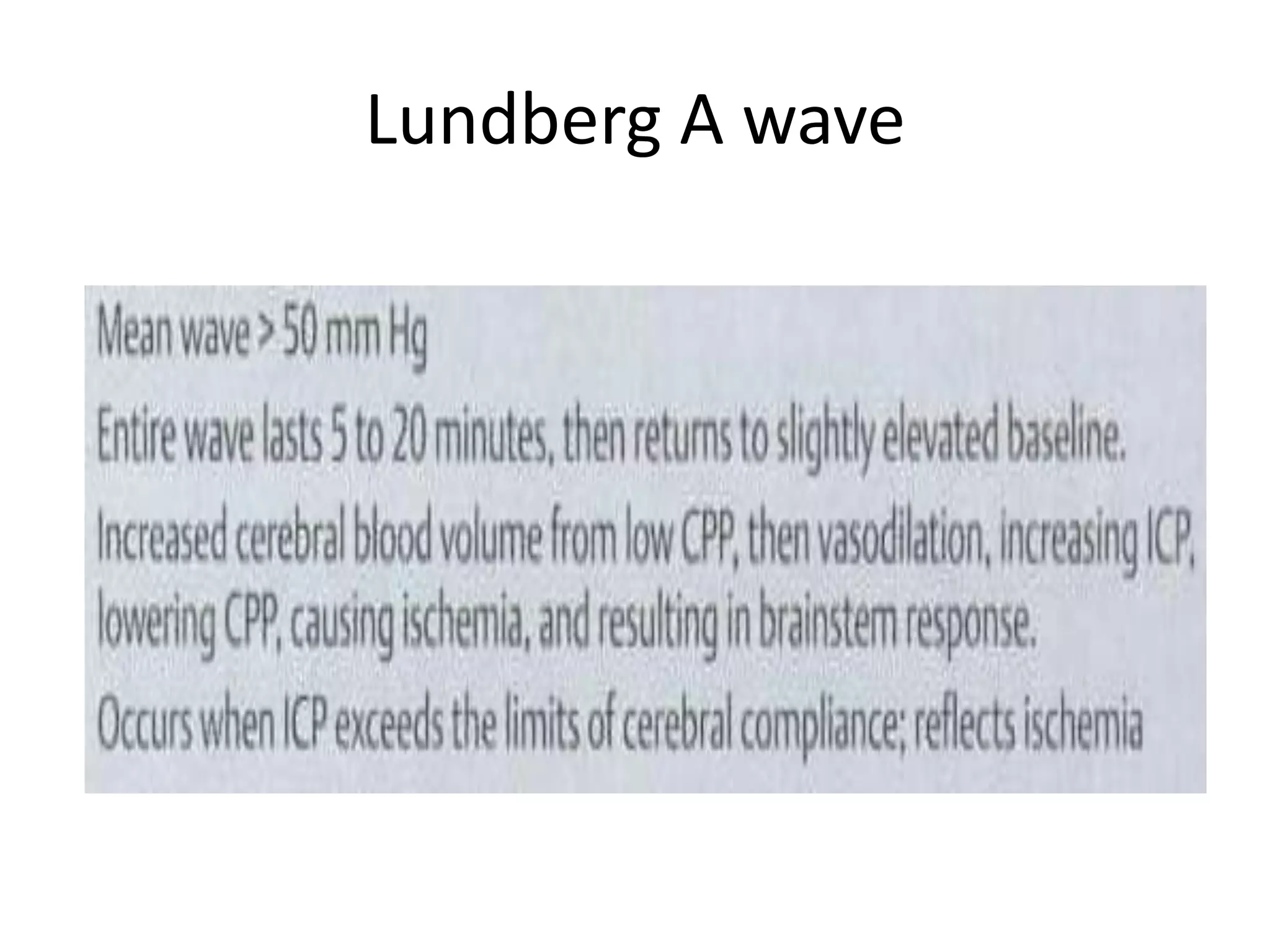 Lundberg A wave

 