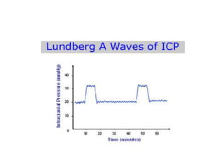 Different Icp Waveforms Intracranial pressure - waveforms and monitoring | PPSX