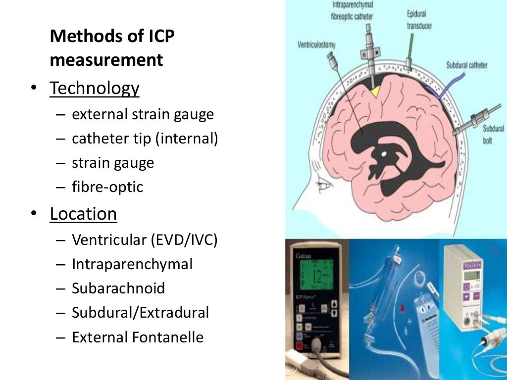 Intracranial pressure waveforms and monitoring