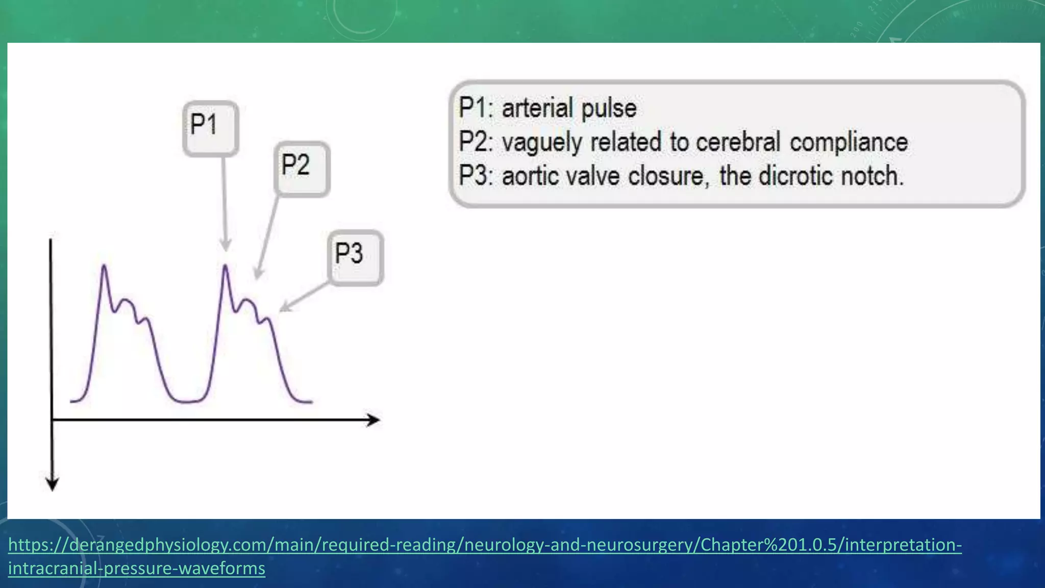 https://derangedphysiology.com/main/required-reading/neurology-and-neurosurgery/Chapter%201.0.5/interpretation-
intracranial-pressure-waveforms
 