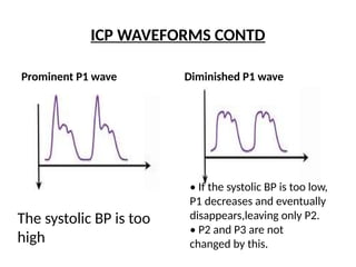 Different Icp Waveforms Intracranial pressure monitoring and control | PPTX