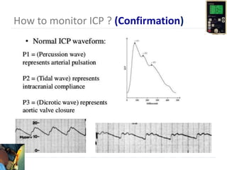 Leftcom Icp ICP mONITORING.ppt