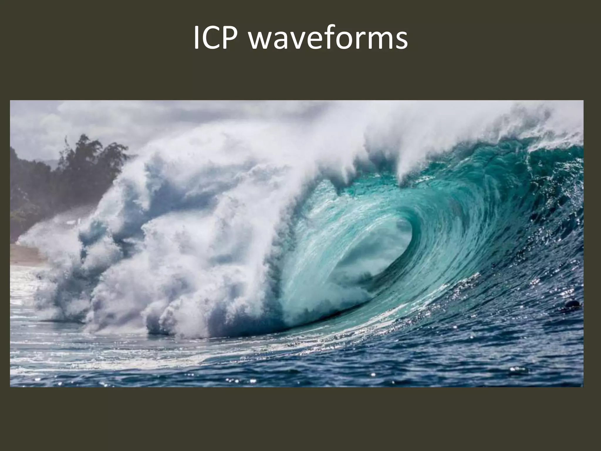 ICP waveforms
 