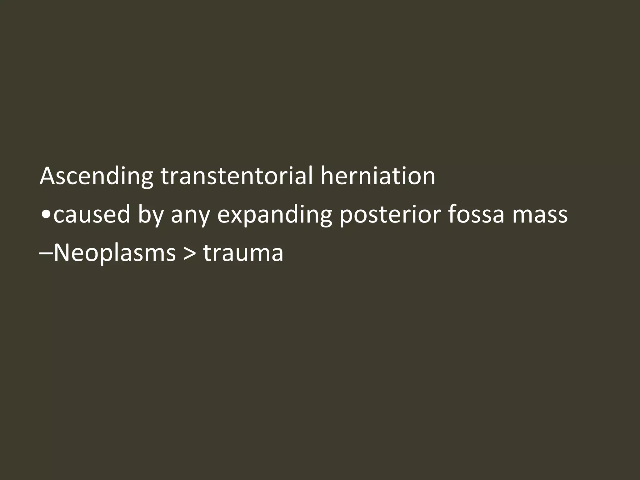 Ascending transtentorial herniation
•caused by any expanding posterior fossa mass
–Neoplasms > trauma
 