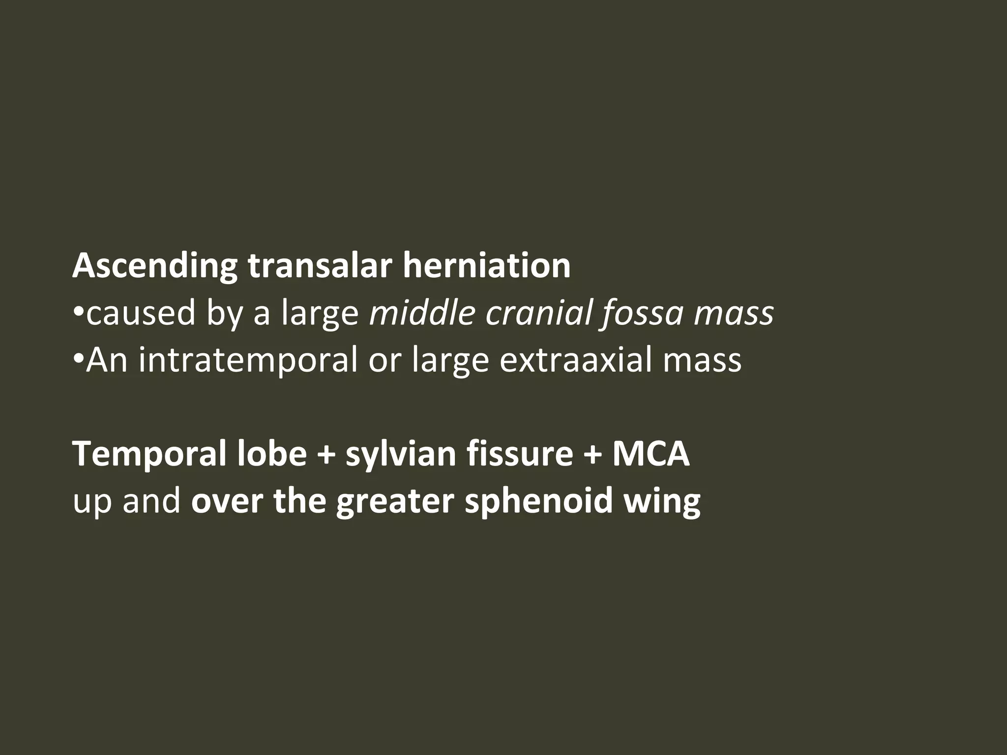 Ascending transalar herniation
•caused by a large middle cranial fossa mass
•An intratemporal or large extraaxial mass
Temporal lobe + sylvian fissure + MCA
up and over the greater sphenoid wing
 