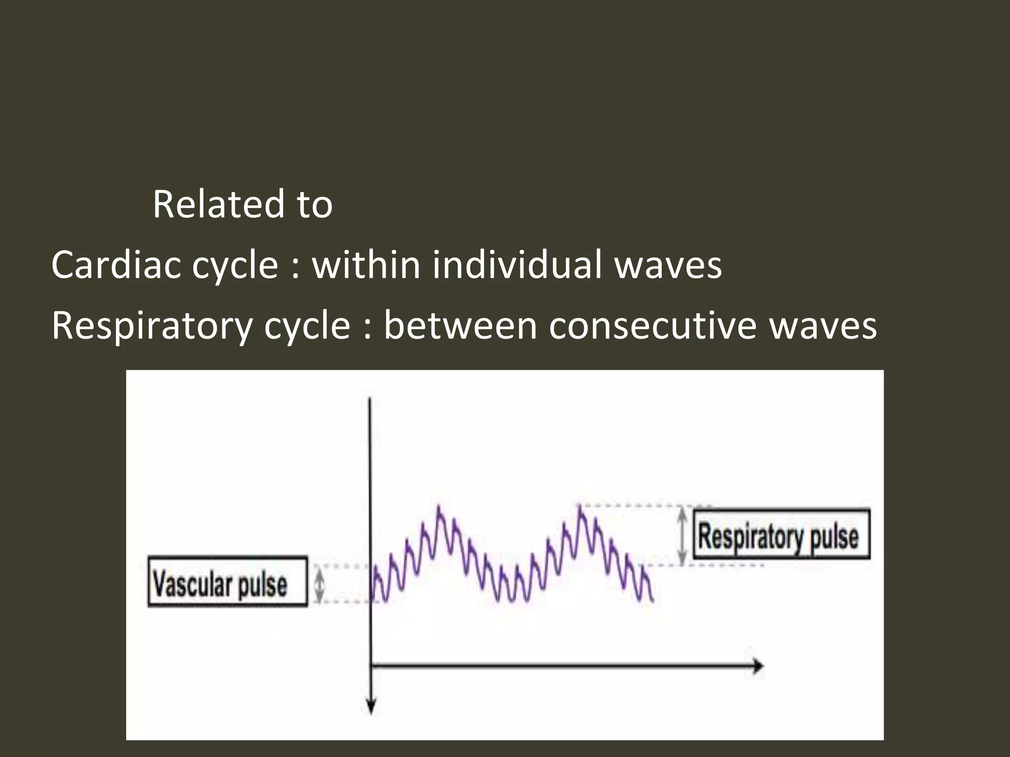 Related to
Cardiac cycle : within individual waves
Respiratory cycle : between consecutive waves
 