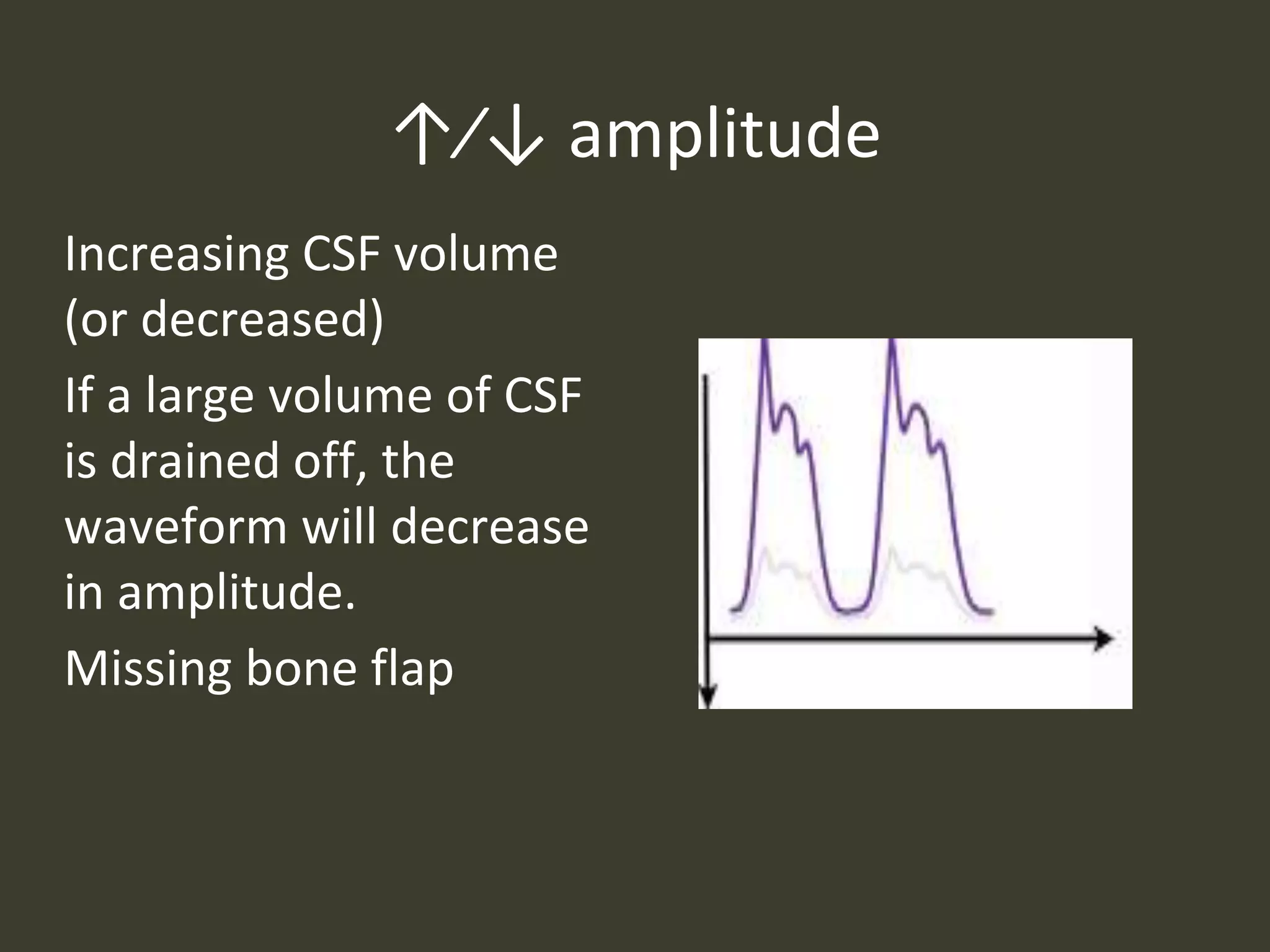 ↑⁄↓ amplitude
Increasing CSF volume
(or decreased)
If a large volume of CSF
is drained off, the
waveform will decrease
in amplitude.
Missing bone flap
 