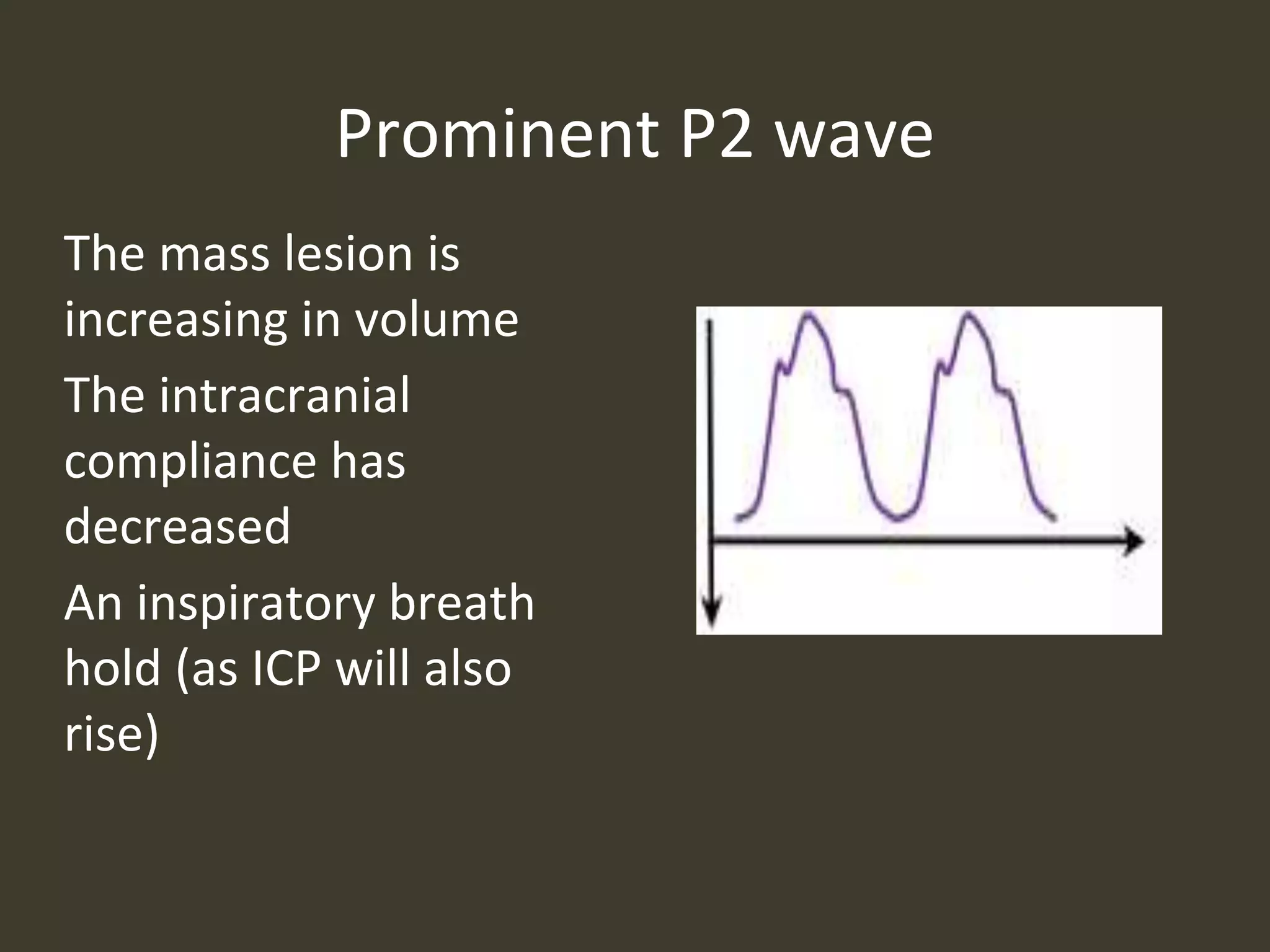 Prominent P2 wave
The mass lesion is
increasing in volume
The intracranial
compliance has
decreased
An inspiratory breath
hold (as ICP will also
rise)
 