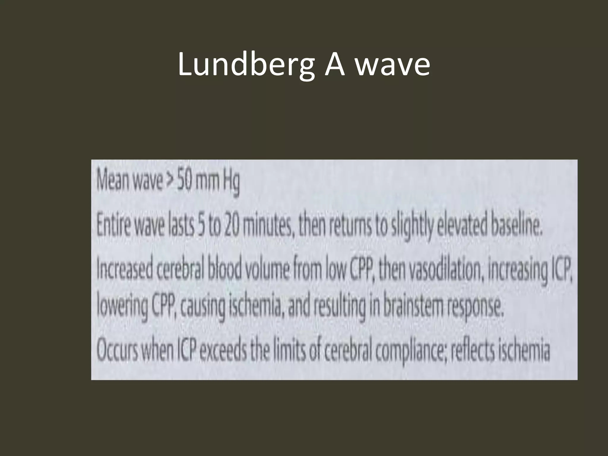 Lundberg A wave
 