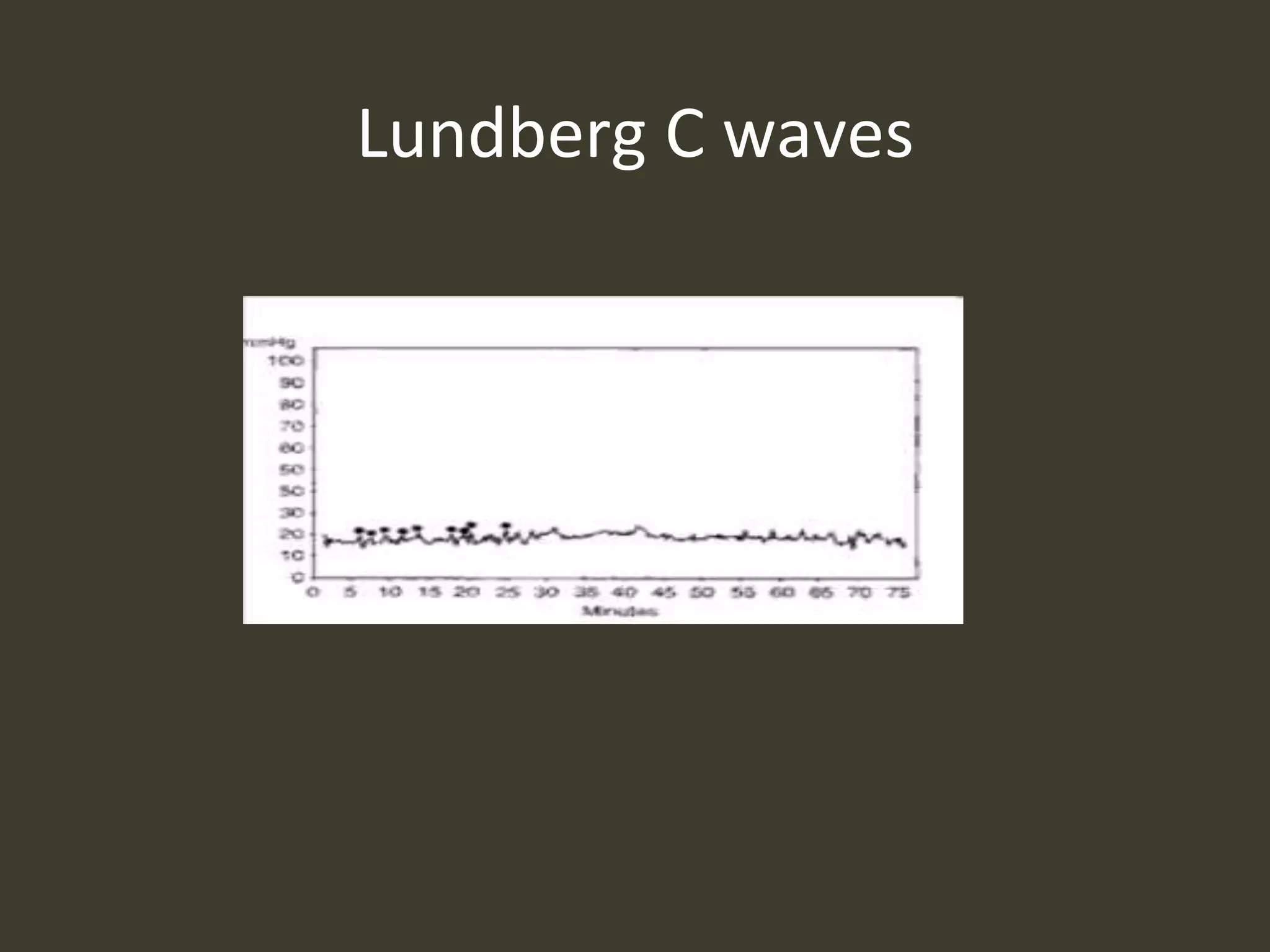 Lundberg C waves
 