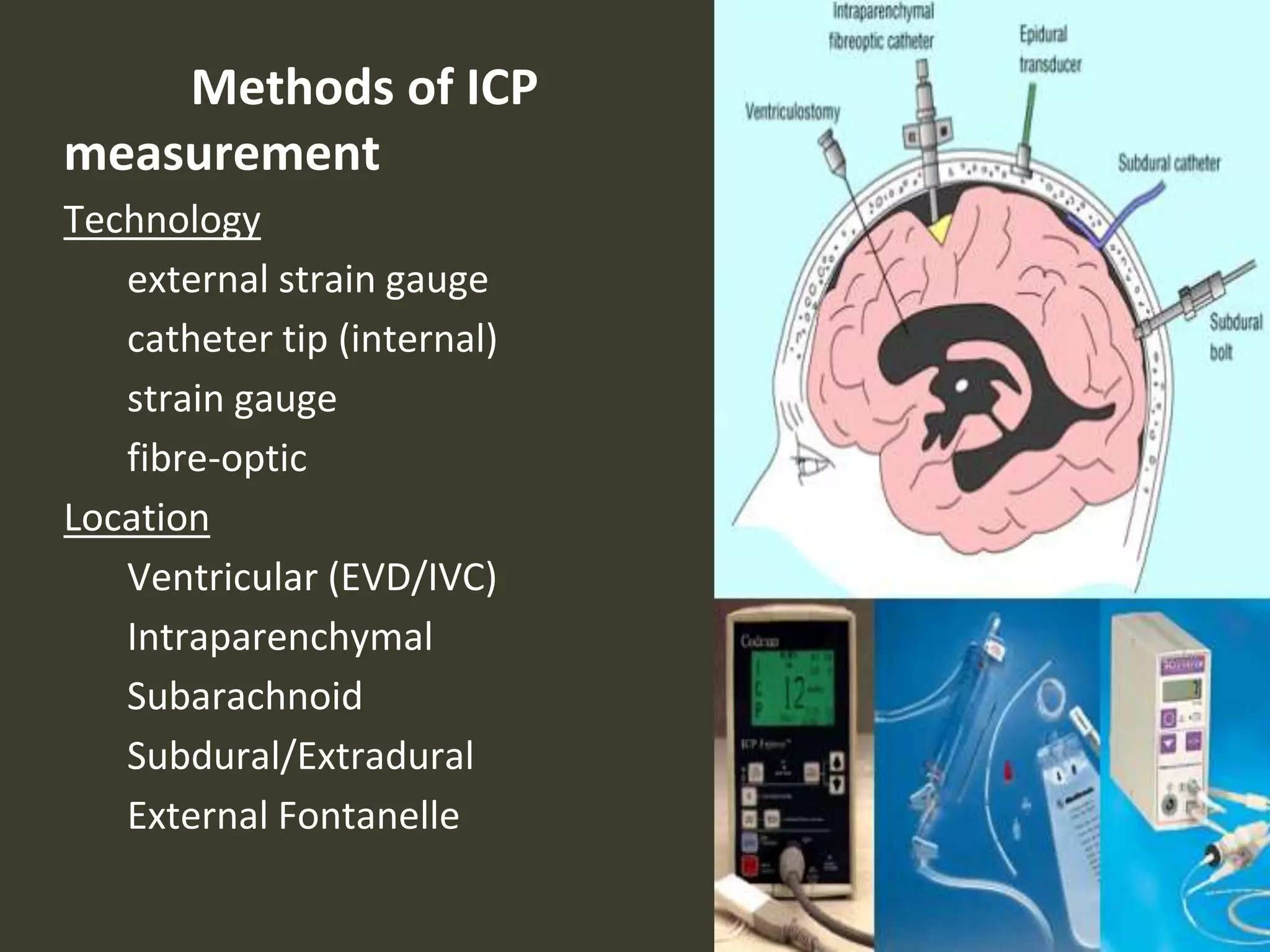 Methods of ICP
measurement
Technology
external strain gauge
catheter tip (internal)
strain gauge
fibre-optic
Location
Ventricular (EVD/IVC)
Intraparenchymal
Subarachnoid
Subdural/Extradural
External Fontanelle
 