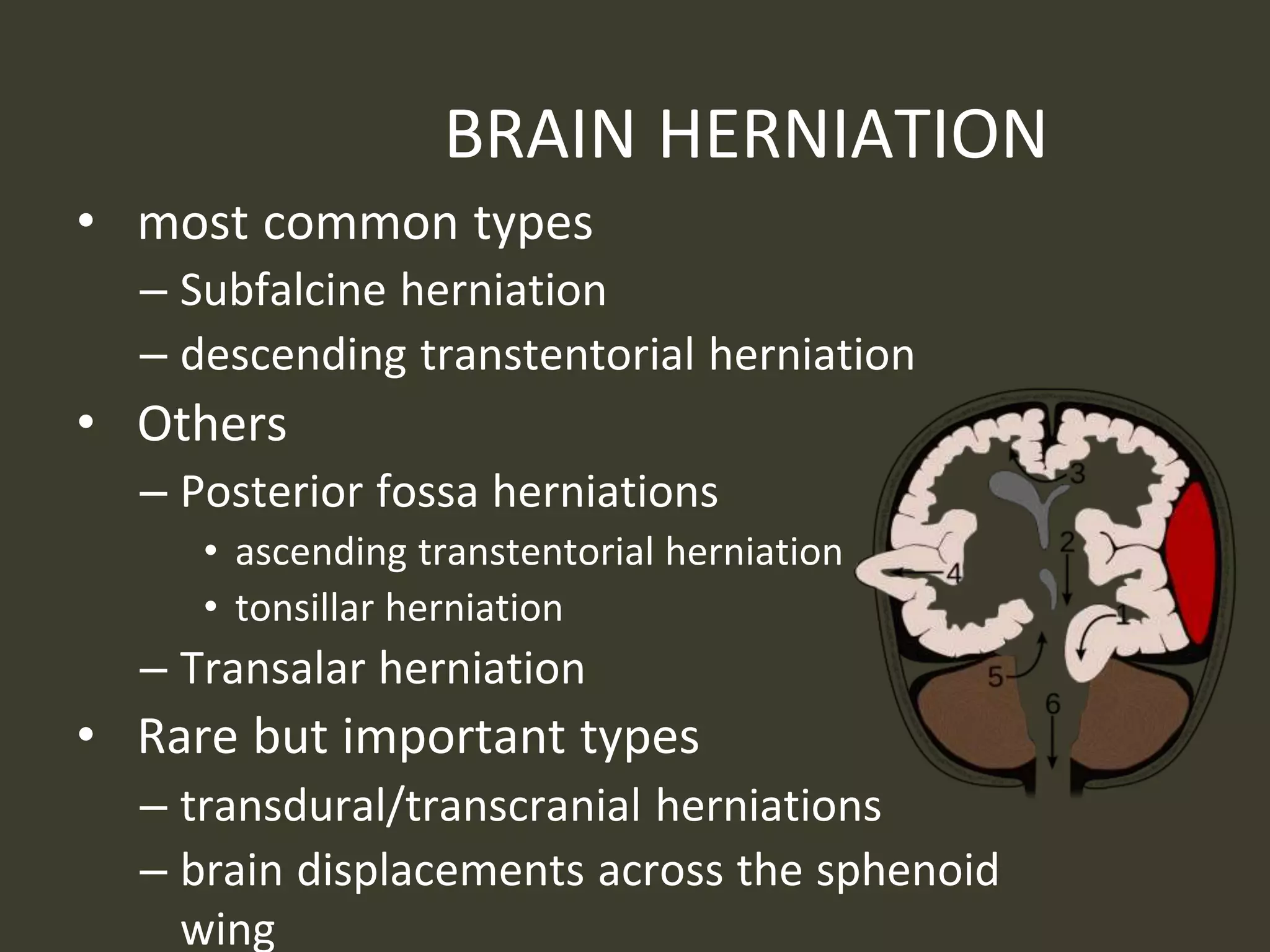 BRAIN HERNIATION
• most common types
– Subfalcine herniation
– descending transtentorial herniation
• Others
– Posterior fossa herniations
• ascending transtentorial herniation
• tonsillar herniation
– Transalar herniation
• Rare but important types
– transdural/transcranial herniations
– brain displacements across the sphenoid
wing
 