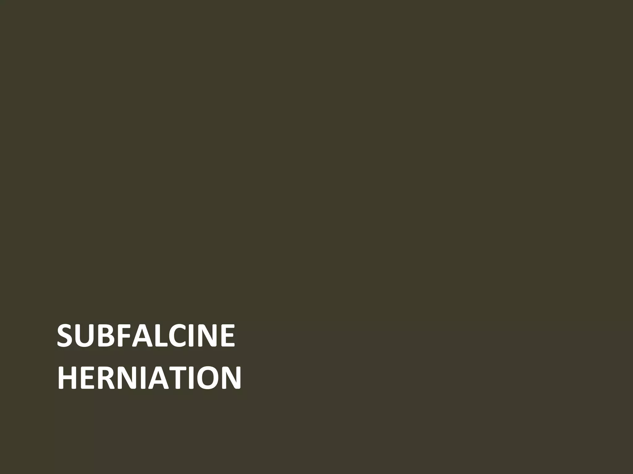 SUBFALCINE
HERNIATION
 