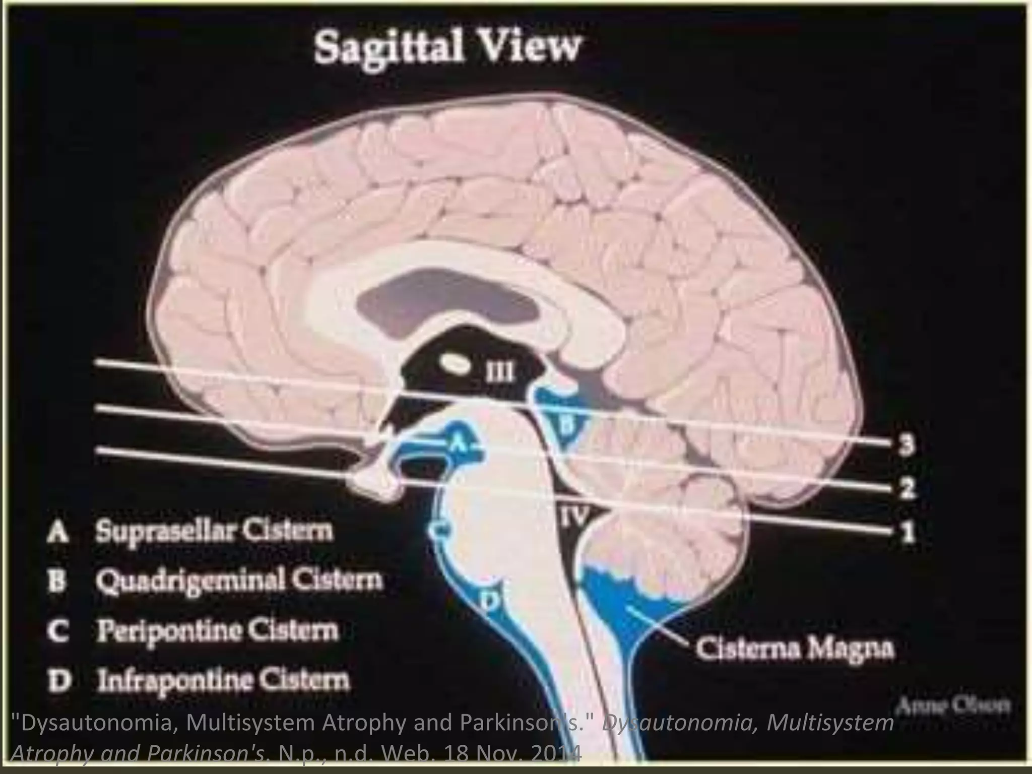 "Dysautonomia, Multisystem Atrophy and Parkinson's." Dysautonomia, Multisystem
Atrophy and Parkinson's. N.p., n.d. Web. 18 Nov. 2014
 