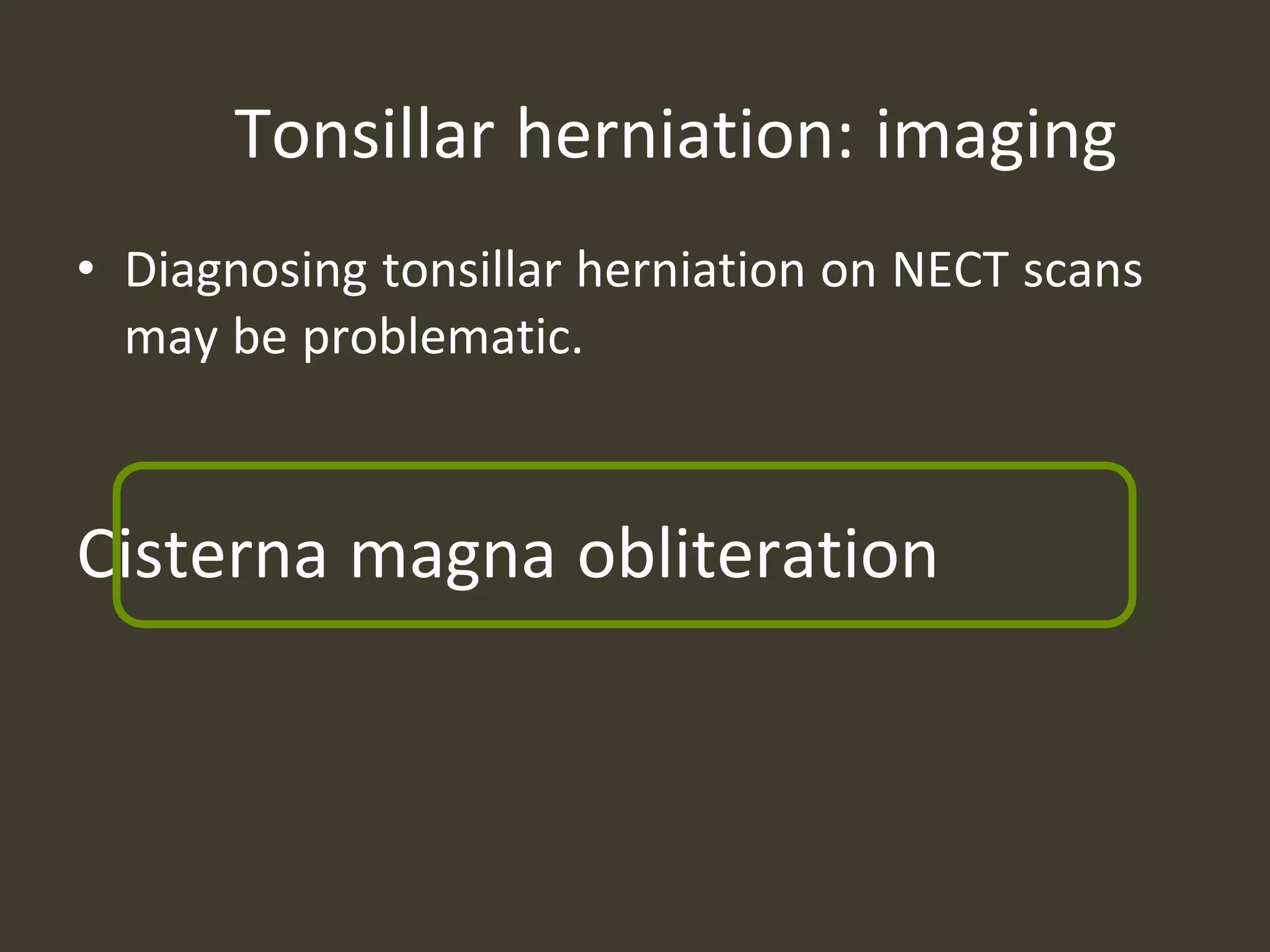 Tonsillar herniation: imaging
• Diagnosing tonsillar herniation on NECT scans
may be problematic.
Cisterna magna obliteration
 