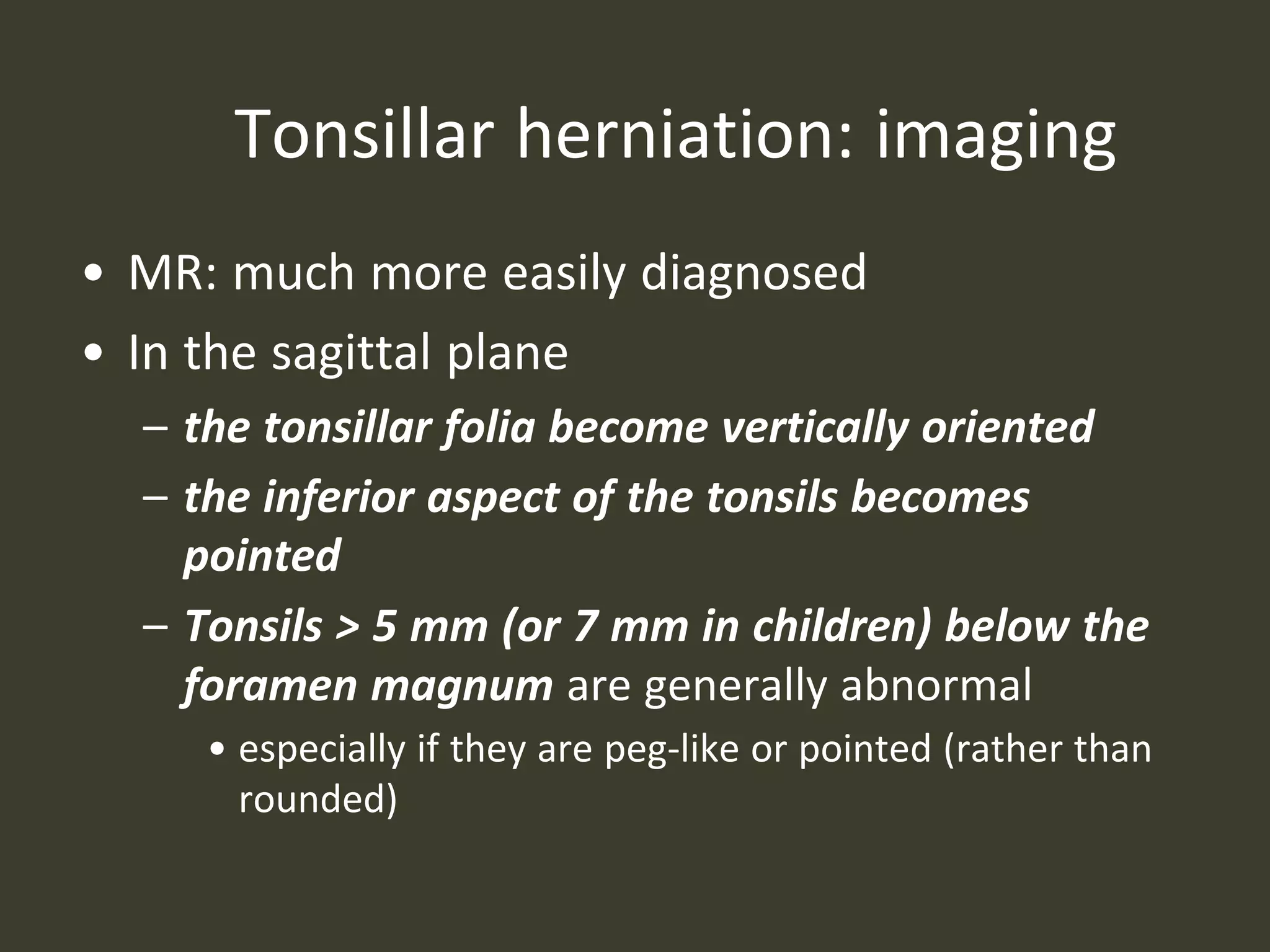 Tonsillar herniation: imaging
• MR: much more easily diagnosed
• In the sagittal plane
– the tonsillar folia become vertically oriented
– the inferior aspect of the tonsils becomes
pointed
– Tonsils > 5 mm (or 7 mm in children) below the
foramen magnum are generally abnormal
• especially if they are peg-like or pointed (rather than
rounded)
 
