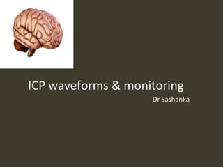 ICP waveforms & monitoring
Dr Sashanka
 