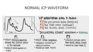 Icp Waveform Examples ICP, REGULATING MACHANISM AND MANAGEMENT OF RAISED.pptx