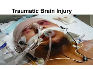 Traumatic Brain Injury
 