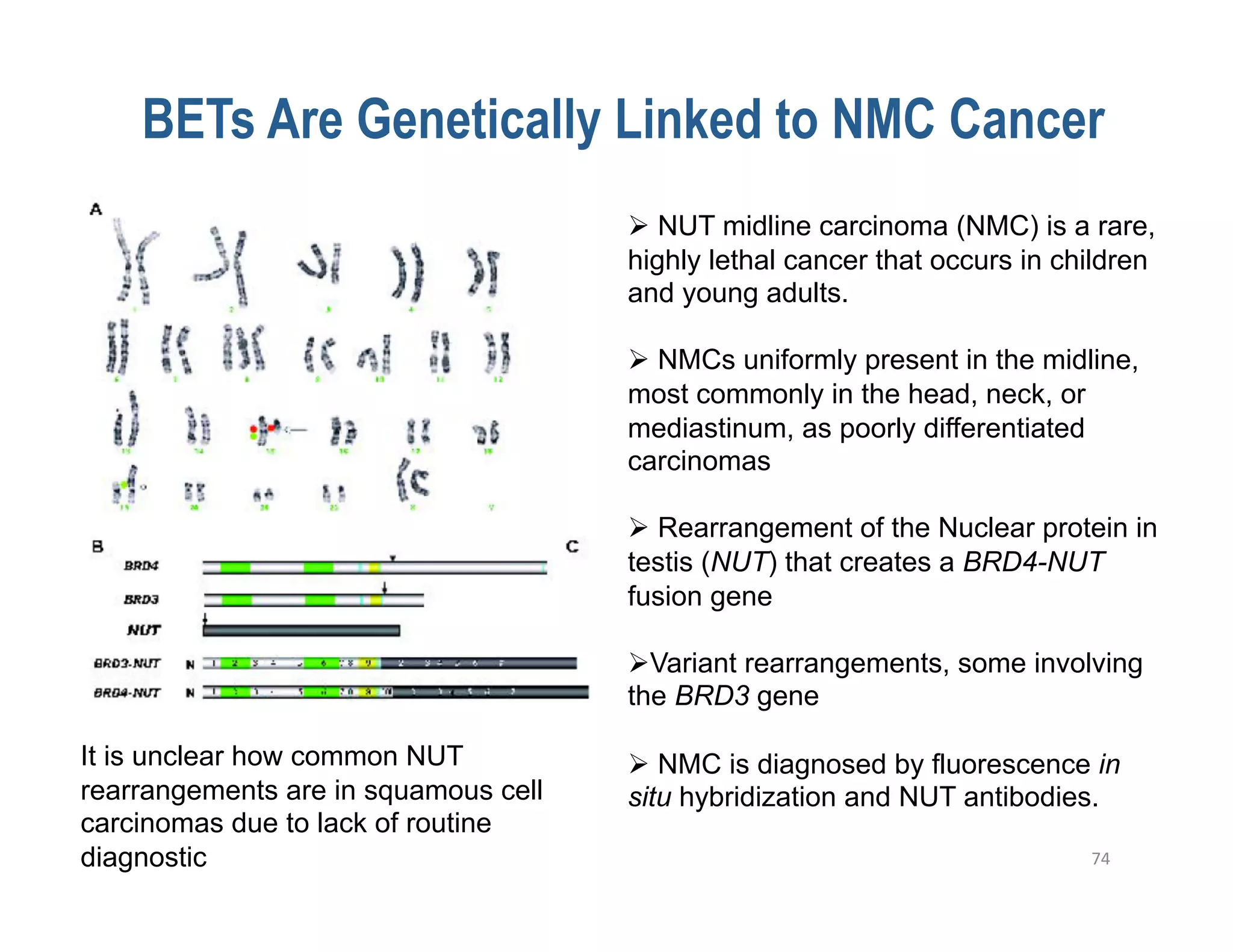   NUT midline carcinoma (NMC) is a rare,
                                      highly lethal cancer that occurs in children
                                      and young adults.

                                        NMCs uniformly present in the midline,
                                      most commonly in the head, neck, or
                                      mediastinum, as poorly differentiated
                                      carcinomas

                                        Rearrangement of the Nuclear protein in
                                      testis (NUT) that creates a BRD4-NUT
                                      fusion gene

                                       Variant rearrangements, some involving
                                      the BRD3 gene

It is unclear how common NUT            NMC is diagnosed by fluorescence in
rearrangements are in squamous cell   situ hybridization and NUT antibodies.
carcinomas due to lack of routine
diagnostic                                                                  74	
  
 